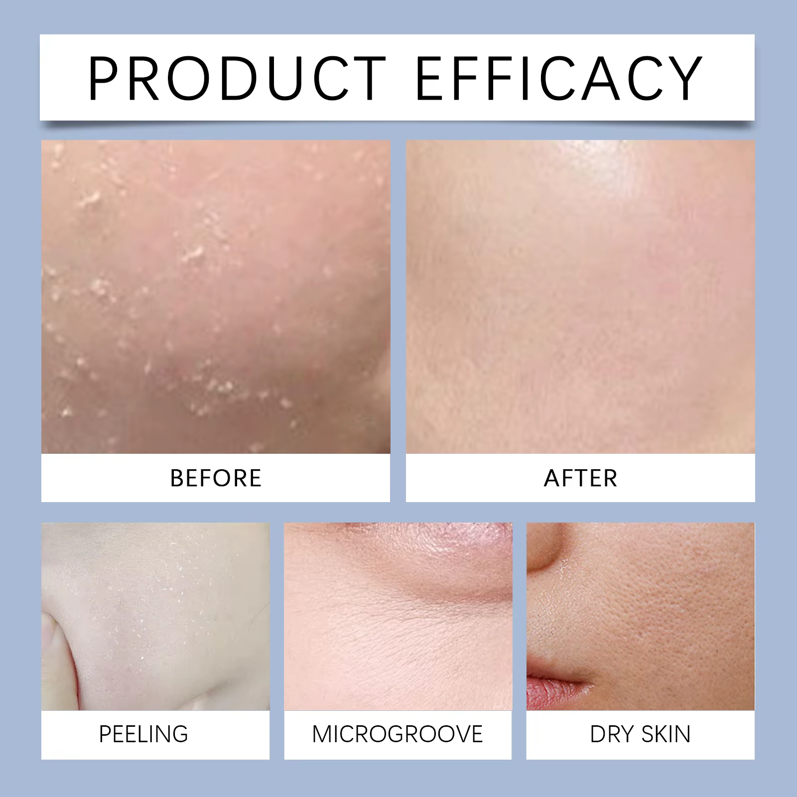 Brightens Skin Tone And Tightens Skin With Hyaluronic Collagen Hydrating Facial Mask - Image 2