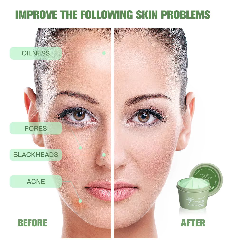 Natural Skincare Deeply Cleansing Pore Nourishing Clay Skin Care Face Mud Mask - Image 5