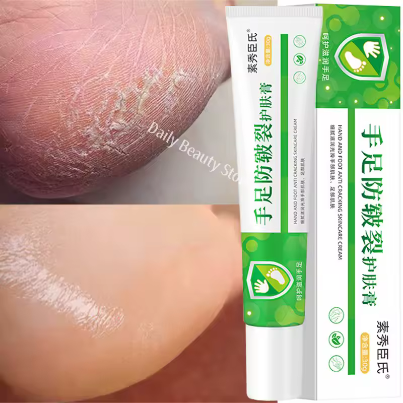 Foot Cream Heel Cracking Repair Products Exfoliation Dead Skin Removal