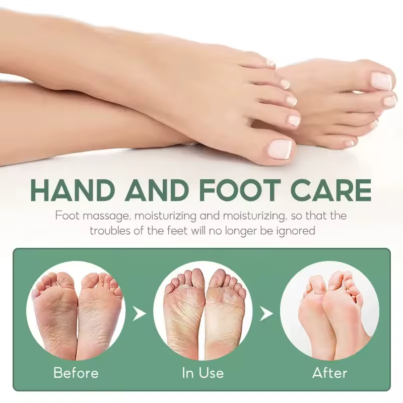 Foot Cream Heel Cracking Repair Products Exfoliation Dead Skin Removal - Image 4