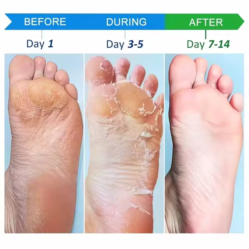 Foot Cream Heel Cracking Repair Products Exfoliation Dead Skin Removal - Image 3