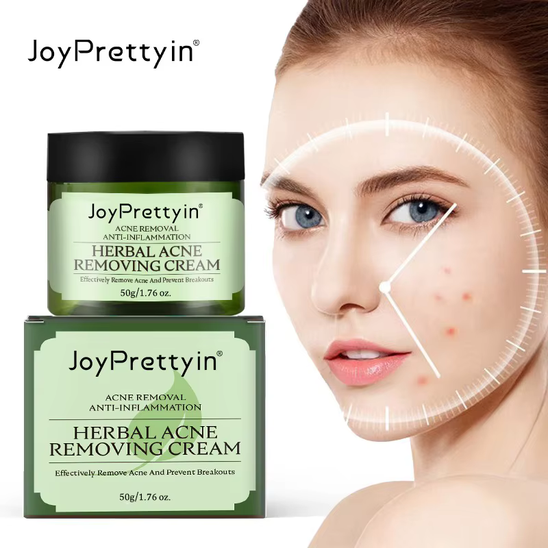 Herbal Acne Moving Cream Long Lasting Moisturizing Oil Control Fading Acne Scars Marks