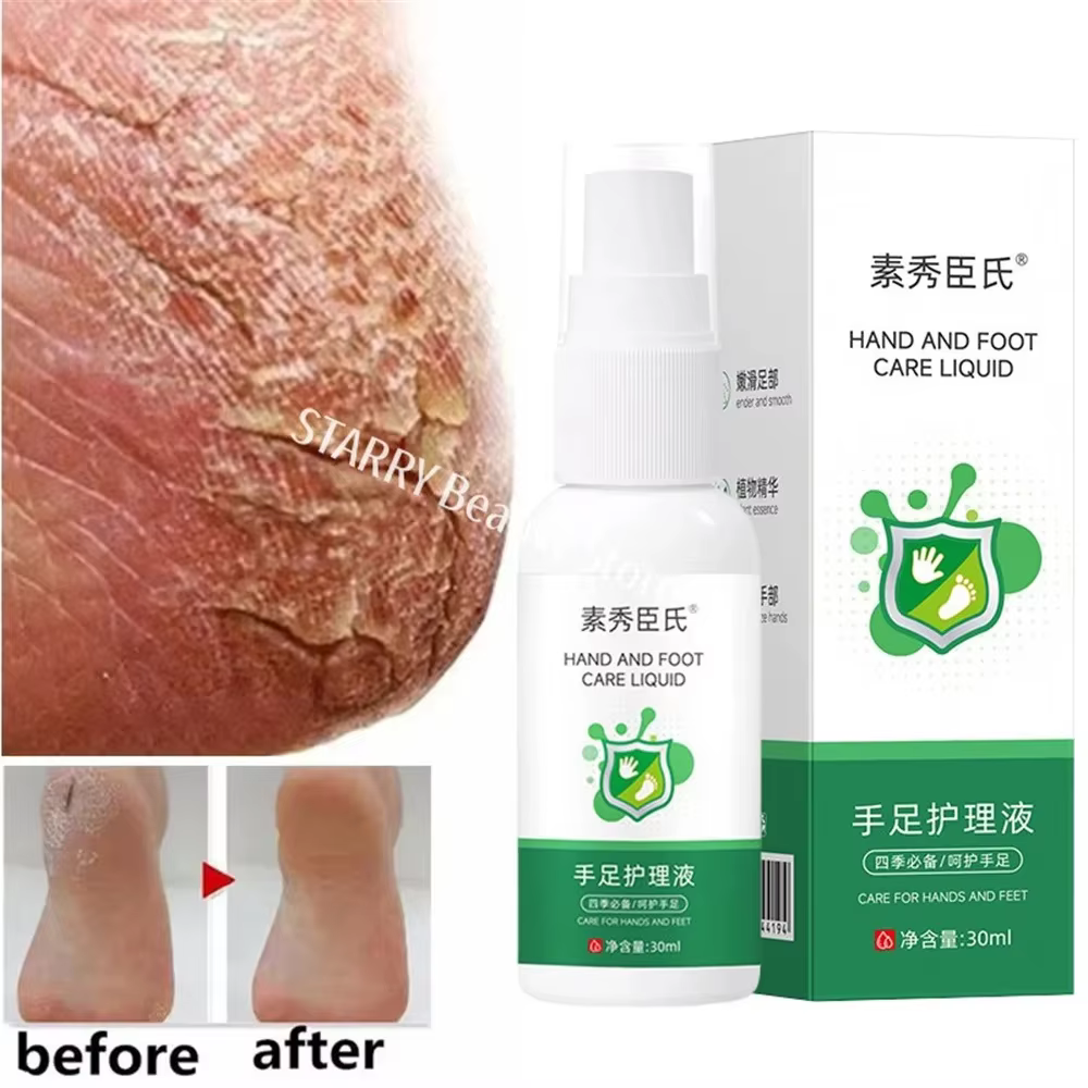 Herbal Anti Crack Foot Spray Heel Cracking Repair Products Exfoliation Dead Skin Removal