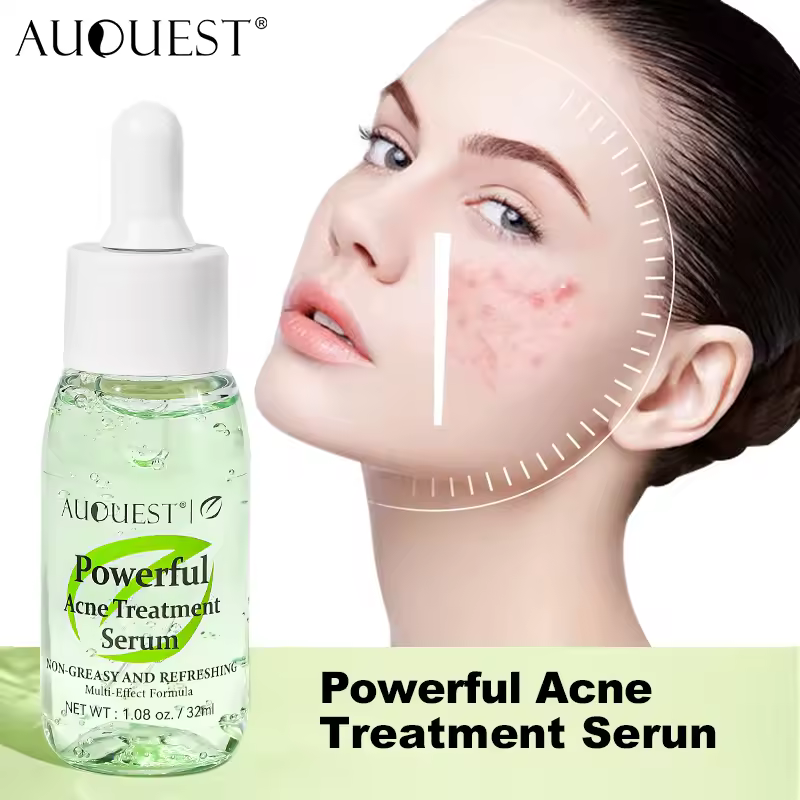 Salicylic Acid Acne Treatment Face Serum Pimple Remover Oil Control Facial Herbal Acne Skin Care